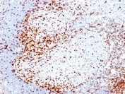 IHC analysis of formalin-fixed, paraffin-embedded human tonsil stained with ZAP70 antibody (clone 2F3.2).
