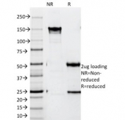 SDS-PAGE analysis of purified, BSA-free ZAP70 Antibody / Immune Tolerance Signaling Antibody (clone SPM362) as confirmation of integrity and purity.