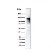 CAD Antibody / Caldesmon CALD1 Isoform-Specific Functional Protein Antibody. Western blot analysis of Caldesmon (CALD1) in human ovary tissue lysate. Lane 1: human ovary tissue lysate. A band is detected at approximately 120-150 kDa, consistent with the predicted molecular weight of Caldesmon / CALD1 and representing the high molecular weight h-caldesmon isoform associated with smooth muscle phenotype. CALD1 is known to produce multiple isoforms, with lower molecular weight forms typically observed at approximately 70-80 kDa in non-muscle cells. The observed banding pattern reflects isoform-specific expression and functional diversity of caldesmon across different cellular contexts.