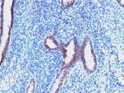 Cyclin B1 Antibody Endometrial Tissue IHC. Immunohistochemistry staining demonstrates Cyclin B1 expression within epithelial cell populations, with HRP-DAB brown staining localized predominantly to glandular epithelial structures. Cyclin B1 is a key regulator of G2/M cell cycle progression that controls entry into mitosis through formation of the Cyclin B1-CDK1 complex. The observed staining pattern is consistent with proliferative cellular compartments where active cell cycle regulation is required for tissue maintenance and growth. Cyclin B1 expression is widely utilized as a marker of cellular proliferation and mitotic activity in both normal and neoplastic tissues.