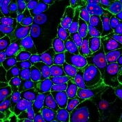 Cyclin B1 Antibody IF. Immunofluorescent staining of human MCF7 cells using Cyclin B1 Antibody / Cell Cycle Regulator Antibody (clone CCNB1/1098) demonstrates prominent red fluorescence localized predominantly within cell nuclei, consistent with Cyclin B1 expression in actively cycling cells. Cyclin B1 is a key regulator of G2/M phase progression and forms a functional complex with CDK1 to control entry into mitosis. The observed nuclear staining pattern is consistent with the role of Cyclin B1 in regulating cell cycle progression and mitotic activity. CF488-conjugated phalloidin (green) highlights the actin cytoskeleton and cell boundaries, while Hoechst stain (blue) identifies cell nuclei. Red = Cyclin B1 antibody; Green = actin cytoskeleton; Blue = nuclei.