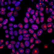 Cyclin B1 Antibody Nuclear IF. Immunofluorescence analysis of formaldehyde-fixed human MCF-7 cells stained with Cyclin B1 Antibody / Cell Cycle Regulator Antibody (clone CCNB1/1098) demonstrates strong red fluorescence localized predominantly within cell nuclei. The staining pattern is consistent with Cyclin B1 expression in actively proliferating cells progressing through the G2/M phase of the cell cycle. Cyclin B1 functions as a regulatory partner of CDK1 and plays a critical role in controlling mitotic entry, chromosome condensation, and cell division. The prominent nuclear localization observed in this preparation is consistent with the established role of Cyclin B1 in cell cycle regulation and proliferative activity. Nuclei are counterstained with Hoechst (blue). Red = Cyclin B1 antibody; Blue = Hoechst nuclear stain.