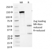 SDS-PAGE Analysis of Purified, BSA-Free CD1A Antibody (clone 66IIC7). Confirmation of Integrity and Purity of the Antibody.