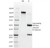 CD38 Antibody Clone AT1 SDS-PAGE. SDS-PAGE analysis of purified, BSA-free CD38 antibody clone AT1 under non-reducing (NR) and reducing (R) conditions confirms antibody integrity and purity. A predominant band is observed at approximately 150 kDa under non-reducing conditions, corresponding to intact IgG, while reducing conditions show bands near 50 kDa and 25 kDa representing heavy and light chains, respectively, consistent with expected antibody structure.