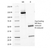 SDS-PAGE Analysis of Purified, BSA-Free Major Vault Protein Antibody for IF / MVP Immunofluorescence Antibody (clone 1014). Confirmation of Integrity and Purity of the Antibody.