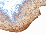 IHC analysis of formalin-fixed, paraffin-embedded human tonsil stained with Cytokeratin 10/13 antibody (clone DE-K13).