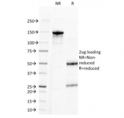 SDS-PAGE Analysis of Purified, BSA-Free Progesterone Antibody (clone 6-5E-3F). Confirmation of Integrity and Purity of the Antibody.
