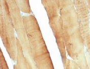 IHC: Formalin-fixed, paraffin-embedded rat skeletal muscle stained with pan Muscle Actin antibody (clone MSA/953).