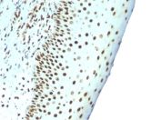 Nuclear Antigen Antibody Tonsil IHC. Immunohistochemistry staining of FFPE human tonsil tissue using Nuclear Antigen Antibody / Pan-Nuclear Marker Antibody (clone NM106) demonstrates strong nuclear HRP-DAB brown staining throughout lymphoid cell populations. The staining pattern is consistent with recognition of a broadly expressed nuclear-associated antigen present within the nuclei of both normal and proliferating cells. Uniform nuclear localization provides clear delineation of cellular distribution and tissue architecture while surrounding non-nuclear compartments remain unstained. As a pan-nuclear marker, clone NM106 is useful for visualization of nuclei, assessment of tissue organization, and subcellular localization studies in both normal and pathological specimens. The observed staining highlights the widespread expression of the target nuclear antigen throughout tonsillar lymphoid tissue.