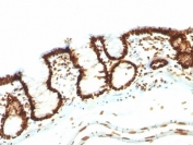 Nuclear Antigen Antibody Rat Colon IHC. Immunohistochemistry staining of FFPE rat colon tissue using Nuclear Antigen Antibody / Pan-Nuclear Marker Antibody (clone NM106) demonstrates strong nuclear HRP-DAB brown staining throughout the epithelial cells lining the colonic mucosa. The staining pattern is consistent with recognition of a broadly expressed nuclear-associated antigen present within the nuclei of diverse cell types. Prominent nuclear localization sharply defines the epithelial architecture of the colonic glands and surface mucosa while providing clear visualization of cellular distribution within the tissue. As a pan-nuclear marker, clone NM106 is useful for identification of nuclei, assessment of tissue morphology, and subcellular localization studies in normal and pathological specimens. The observed staining highlights robust nuclear labeling of the colonic epithelial compartment with minimal non-nuclear background.
