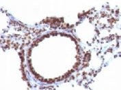 Nuclear Antigen Antibody Rat Lung IHC. Immunohistochemistry staining of FFPE rat lung tissue using Nuclear Antigen Antibody / Pan-Nuclear Marker Antibody (clone NM106) demonstrates strong nuclear HRP-DAB brown staining throughout the pulmonary cellular compartment, including bronchial epithelial cells and cells within the surrounding alveolar tissue. The staining pattern is consistent with recognition of a broadly expressed nuclear-associated antigen present within the nuclei of diverse cell types. Distinct nuclear localization provides excellent visualization of cellular distribution and tissue architecture while minimizing cytoplasmic background staining. As a pan-nuclear marker, clone NM106 is useful for identification of nuclei, assessment of tissue morphology, and subcellular localization studies in both normal and experimental tissue specimens. The observed staining highlights robust and widespread nuclear labeling throughout rat lung tissue.