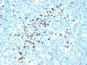 IHC: Formalin-fixed, paraffin-embedded human tonsil stained with IgM antibody (clone DA4-4).