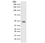 Western blot testing of human HepG2 cell lysate using Cytokeratin 19 antibody cocktail (clone A53-B/A2.26 + BA17). Predicted molecular weight ~43 kDa.