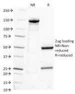 SDS-PAGE Analysis of Purified, BSA-Free IgG Antibody clone IG217. Confirmation of Integrity and Purity of the Antibody.