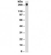 TAG-72 Antibody WB. Western blot testing of Jurkat cell lysate with TAG-72 antibody (clone CC49). Expected molecular weight ~220kDa.