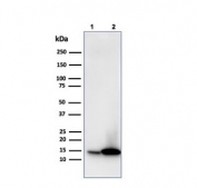 Galectin 1 Antibody Human JEG-3 and K562 WB. Western blot analysis of 1) human JEG-3 and 2) human K562 cell lysates using Galectin 1 antibody (clone GAL1/1831). A strong, distinct band is detected at approximately 14 kDa in both cell lines, consistent with the expected molecular weight of Galectin-1 (LGALS1), a beta-galactoside-binding lectin involved in immune regulation, cell adhesion, angiogenesis, and tumor microenvironment signaling. The results demonstrate specific detection of endogenous Galectin-1 protein and support the utility of clone GAL1/1831 for western blot applications. Predicted molecular weight: ~14 kDa.