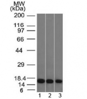 Galectin 1 Antibody Human Cell Line WB. Western blot analysis of 1) human HeLa, 2) human K562, and 3) human HEK293 cell lysates using Galectin 1 antibody (clone GAL1/1831). A strong, discrete band is detected at approximately 14 kDa in all three cell lines, consistent with the expected molecular weight of Galectin-1 (LGALS1). Galectin-1 is a beta-galactoside-binding lectin involved in immune regulation, cell adhesion, apoptosis, angiogenesis, and tumor microenvironment remodeling. The consistent detection of a single prominent band across multiple human cell lines supports the specificity and reliability of clone GAL1/1831 for western blot-based analysis of endogenous Galectin-1 expression. Predicted molecular weight: ~14 kDa.