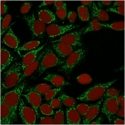 Galectin 1 Antibody HeLa IF. Immunofluorescent staining of permeabilized human HeLa cells using Galectin 1 antibody (clone GAL1/1831, green) demonstrates prominent cytoplasmic staining with a finely granular distribution throughout the cell body. The observed pattern is consistent with the known intracellular localization of Galectin-1 (LGALS1), a beta-galactoside-binding lectin involved in immune regulation, cell adhesion, apoptosis, and extracellular matrix interactions. RedDot nuclear counterstain (red) clearly delineates cell nuclei, while Galectin-1 immunoreactivity is primarily excluded from the nuclear compartment and enriched within the cytoplasm. These results support the utility of clone GAL1/1831 for immunofluorescent detection of endogenous Galectin-1 expression in cultured human cells.