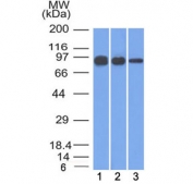 Beta-Catenin Consistency Antibody Human Cell Line WB. Western blot analysis of 1) human A431, 2) A549, and 3) MCF7 cell lysates using Beta-Catenin Antibody (clone 12F7) detects a consistent band at approximately 90-95 kDa across all samples, aligning with the predicted molecular weight of Catenin beta-1 / CTNNB1 at ~85 kDa with a characteristic upward shift during SDS-PAGE. The uniform banding pattern across multiple epithelial and cancer cell lines supports reproducible detection of CTNNB1, consistent with phosphorylation-associated modulation of beta-catenin electrophoretic mobility.