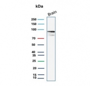 Beta-Catenin Consistency Antibody Brain WB. Western blot analysis of human brain tissue lysate using Beta-Catenin Antibody (clone 12F7) detects a clear band at approximately 90-95 kDa, consistent with the predicted molecular weight of Catenin beta-1 / CTNNB1 at ~85 kDa with a characteristic upward shift during SDS-PAGE. This migration pattern aligns with phosphorylation-associated modulation of beta-catenin mobility and supports reproducible detection of CTNNB1 in neural tissue.