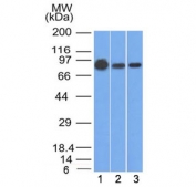 Beta-Catenin Reproducibility Control Antibody Human Cell Line WB. Western blot analysis of 1) human A431, 2) A549, and 3) MCF7 cell lysates using Beta-Catenin Antibody (clone 9F2) detects a consistent band at approximately 90-95 kDa across all samples, aligning with the predicted molecular weight of Catenin beta-1 / CTNNB1 at ~85 kDa with a characteristic upward shift during SDS-PAGE. The uniform banding pattern across multiple epithelial and cancer cell lines supports reproducible detection of CTNNB1, consistent with phosphorylation-associated modulation of beta-catenin electrophoretic mobility.