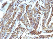 IHC testing of FFPE human uterus stained with Calponin antibody. HIER: steam sections in 10mM Tris with 1mM EDTA, pH 9.0, for 10-20 min.