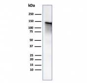 Caldesmon Antibody / CALD1 Cellular Morphology and Structural Integrity Protein Antibody. Western blot analysis of Caldesmon (CALD1) in human ovary tissue lysate. Lane 1: human ovary tissue lysate. A band is detected at approximately 120-150 kDa, consistent with the predicted molecular weight of Caldesmon / CALD1 and representing the high molecular weight h-caldesmon isoform associated with structurally stable smooth muscle cells. Additional lower molecular weight bands may be observed at approximately 70-80 kDa corresponding to non-muscle isoforms that contribute to maintenance of cellular morphology and cytoskeletal integrity. The observed banding pattern reflects isoform-dependent expression of CALD1 linked to preservation of cell shape and structural organization.