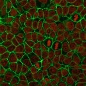 Cadherin 1 Antibody for IF. Immunofluorescence analysis of E-Cadherin / CDH1 expression in human MCF7 cells using clone 4A2 antibody (green), showing sharp membrane staining outlining individual epithelial cell boundaries, with Reddot nuclear stain (red). Signal highlights clear cell perimeter definition and uniform epithelial cell organization across the monolayer.