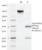 SDS-PAGE Analysis of Purified Gamma Catenin Antibody (clone CTNG/1664). Confirmation of Purity and Integrity of Antibody.