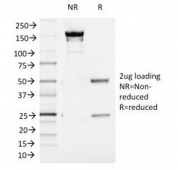 SDS-PAGE Analysis of Purified, BSA-Free Aurora B Antibody (clone AURKB/1521). Confirmation of Integrity and Purity of the Antibody.