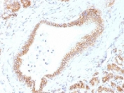 Beta Catenin Antibody Pancreas Immunohistochemistry. IHC testing of FFPE human pancreas tissue with Beta Catenin antibody (clone CTNNB1/1507). Required HIER: boil tissue sections in 10mM Tris with 1mM EDTA, pH 9.0, for 10-20 min.