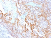 Beta Catenin Antibody Clone 15B8 Immunohistochemistry.IHC testing of FFPE human tonsil tissue with Beta Catenin antibody (clone 15B8). Required HIER: boil tissue sections in 10mM Tris with 1mM EDTA, pH 9.0, for 10-20 min.