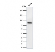 Beta Catenin Antibody Clone 15B8 WB. Western blot testing of human HeLa cell lysate with Beta Catenin antibody (clone 15B8). Predicted molecular weight ~85 kDa, but routinely observed at 90-95 kDa.