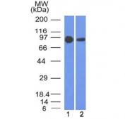 Beta-Catenin Antibody Clone 5H10 WB. Western blot testing of human 1) A431 and 2) A549 cell lysate with Beta Catenin antibody (clone 5H10). Predicted molecular weight ~85 kDa, but routinely observed at 90-95 kDa.