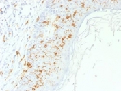 CD1A Antibody for IHC. Immunohistochemistry analysis of CD1A / CD1a expression in FFPE human skin tissue using CD1A Antibody. Membranous and cytoplasmic staining is observed in dendritic cells within the epidermis and superficial dermis, consistent with Langerhans cell localization, while surrounding keratinocytes remain largely negative. The distribution and density of CD1a-positive cells along the epithelial interface support evaluation of dendritic cells involved in local immune regulation and modulation of T-cell responses within skin. Required HIER: boil tissue sections in 10 mM citrate buffer, pH 6, for 10-20 minutes.