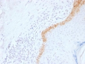 IHC testing of FFPE human skin with Keratin 15 antibody (clone LHK15). Required HIER: boil tissue sections in 10mM citrate buffer, pH 6, for 10-20 min.