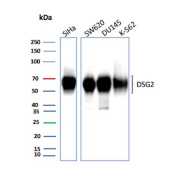 Desmoglein-2 Antibody 8E5 Multi-Cell Line WB. Western blot analysis of human SiHa, SW620, DU145, and K-562 cell lysates using Desmoglein-2 antibody detecting DSG2. A band is observed at approximately 55-70 kDa across multiple samples, consistent with a processed or truncated form of Desmoglein 2, while the full-length protein is typically expected at a higher molecular weight depending on glycosylation. Signal is more prominent in epithelial-derived cell lines such as SiHa, SW620, and DU145, consistent with DSG2 expression in cells forming desmosomal adhesion complexes that support intercellular junction integrity, whereas K-562 cells show comparatively reduced signal.