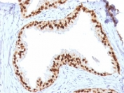 IHC testing of FFPE human prostate with FOXA1 antibody (clone FOXA1/1512). HIER: boil sections in 10mM Tris with 1mM EDTA, pH9, for 10-20 min.