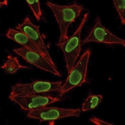 Histone H1 Antibody for IF. Immunofluorescence analysis of chromatin differentiation-associated histone H1 expression in PFA-fixed human HeLa cells using Histone H1 Antibody (green). Strong nuclear staining is observed, consistent with localization of linker histone H1 within chromatin and its role in dynamic chromatin remodeling during cellular differentiation. The staining pattern highlights uniform nuclear distribution reflecting chromatin-associated H1 across cells. Actin filaments are labeled with phalloidin (red), providing cytoskeletal contrast to the chromatin-associated histone signal.