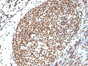 Histone H1 Antibody for IHC. Immunohistochemistry analysis of chromatin differentiation-associated histone H1 expression in FFPE human tonsil tissue using Histone H1 Antibody. Nuclear HRP-DAB brown staining is observed in lymphoid cells, consistent with localization of linker histone H1 within chromatin and its role in dynamic chromatin remodeling during cellular differentiation. The staining highlights strong nuclear compartmentalization with minimal cytoplasmic signal, reflecting chromatin-associated distribution across actively remodeling chromatin states.