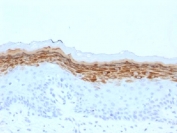 Filaggrin Antibody Epidermis IHC. Immunohistochemistry analysis of formalin-fixed, paraffin-embedded human skin tissue using Filaggrin antibody (clone FLG/1561). Strong cytoplasmic staining is observed in the upper layers of the epidermis, consistent with localization in differentiated keratinocytes, while basal epidermal layers and underlying dermal tissue show minimal background staining. Nuclei are counterstained in blue. Heat-induced antigen retrieval was performed by boiling tissue sections in 10 mM citrate buffer, pH 6.0, for 10â20 minutes prior to staining.