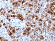 GP2 Antibody Human Pancreas IHC. Immunohistochemistry testing of FFPE human pancreas with GP2 antibody (clone GP2/1712). HIER: boil tissue sections in 10mM Tris with 1mM EDTA, pH 9, for 10-20 min.