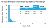 GP2 Antibody Microarray Specificity Validation. Analysis of HuProt(TM) microarray containing more than 19,000 full-length human proteins using GP2 antibody (clone GP2/1712). These results demonstrate the foremost specificity of the GP2/1712 mAb.<BR>Z- and S- score: The Z-score represents the strength of a signal that an antibody (in combination with a fluorescently-tagged anti-IgG secondary Ab) produces when binding to a particular protein on the HuProt(TM) array. Z-scores are described in units of standard deviations (SD's) above the mean value of all signals generated on that array. If the targets on the HuProt(TM) are arranged in descending order of the Z-score, the S-score is the difference (also in units of SD's) between the Z-scores. The S-score therefore represents the relative target specificity of an Ab to its intended target.