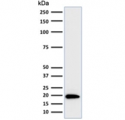 Ferritin Light Chain Antibody HeLa Cell. Western blot testing of human HeLa lysate with Ferritin Light Chain Antibody for Western Blotting (clone FTL/1386). Predicted molecular weight: ~20 kDa.
