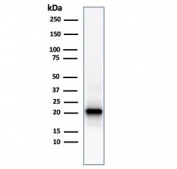 Ferritin Light Chain Antibody Kidney Tissue WB. Western blot testing of human kidney lysate with Ferritin Light Chain Antibody for Western Blotting (clone FTL/1386). Predicted molecular weight: ~20 kDa.