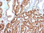 FTL Antibody Biotin Conjugate Renal Tubule IHC. Immunohistochemistry analysis of FFPE human kidney tissue stained with FTL Antibody Biotin Conjugate demonstrates diffuse granular cytoplasmic HRP-DAB brown staining throughout renal tubular epithelial structures, consistent with expression of ferritin light chain / FTL in metabolically active tubular compartments involved in ferritin nanocage organization and intracellular iron sequestration. This ferritin nanocage protein antibody highlights ferritin-associated oxidative stress-responsive pathways within renal epithelial tissue. HIER: boil tissue sections in pH 9 10mM Tris with 1mM EDTA for 10-20 min and allow to cool before testing.