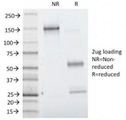 SDS-PAGE Analysis of Purified, BSA-Free Villin Antibody for WB / VIL1 Western Blot Antibody (clone VIL1/1314). Confirmation of Integrity and Purity of the Antibody.