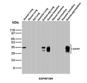 EpCAM Antibody Human Mouse Rat Hamster Guinea pig WB. Western blot testing of human, mouse, rat, hamster and guinea pig tissue lysate samples with EpCAM antibody. Expected molecular weight: ~35 kDa (unmodified), 40-43 kDa (glycosylated).