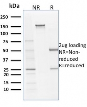SDS-PAGE analysis of purified, BSA-free Filaggrin antibody clone SPM181 as confirmation of integrity and purity.