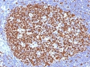 MCM7 Antibody Tonsil IHC. Immunohistochemistry testing of FFPE human tonsil with MCM7 antibody (clone MCM7/1466). Required HIER: boil tissue sections in pH 9 10mM Tris with 1mM EDTA for 10-20 min.